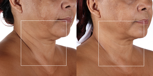 Anti-Aging Device - Pro Skincare Deluxe Moisturizing Kit