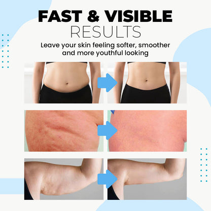 FastLab™ Collagen Revitalizing Strips 🔥 Limited-Time Sale 🔥