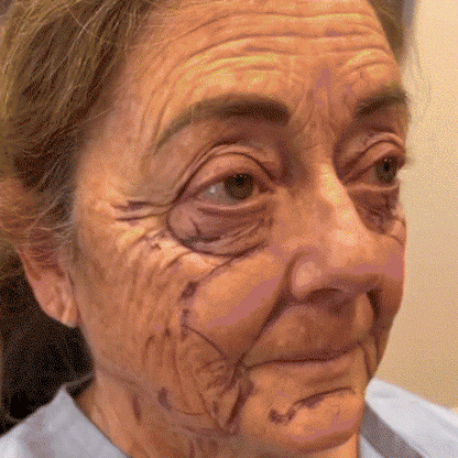 ODALIT™ 7-Day Multi-Effect All-in-One Skincare Cream (👨‍⚕️AAD Recommended)