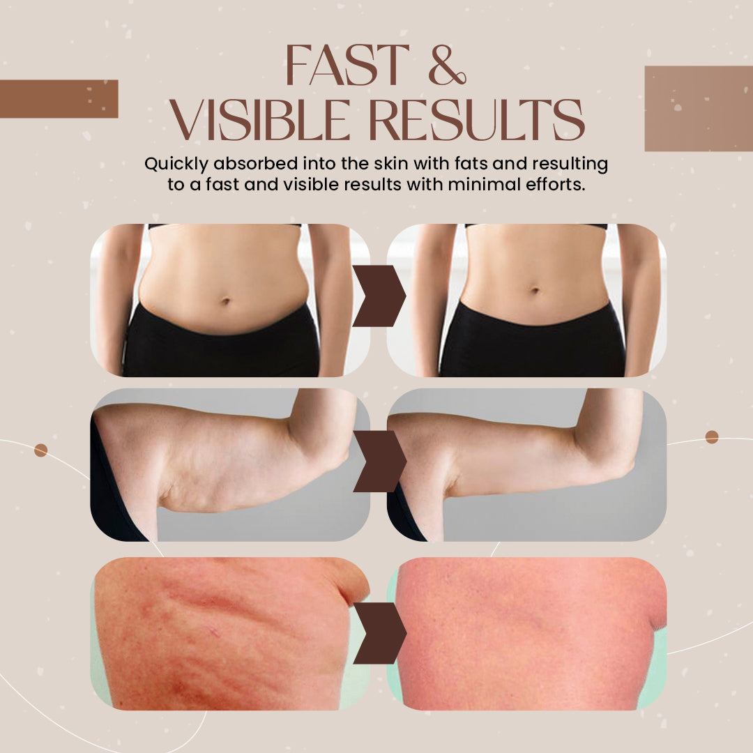 SlimVanish Fat-Melting Miracle Cream