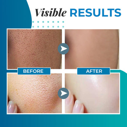 Lactobionic Acid Pore Refining Serum