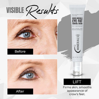 Minerals + Micro-minerals Eye Fat Removal Cream