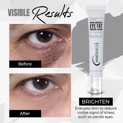 Minerals + Micro-minerals Eye Fat Removal Cream