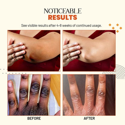 Zakdavi™ Treatment Oil