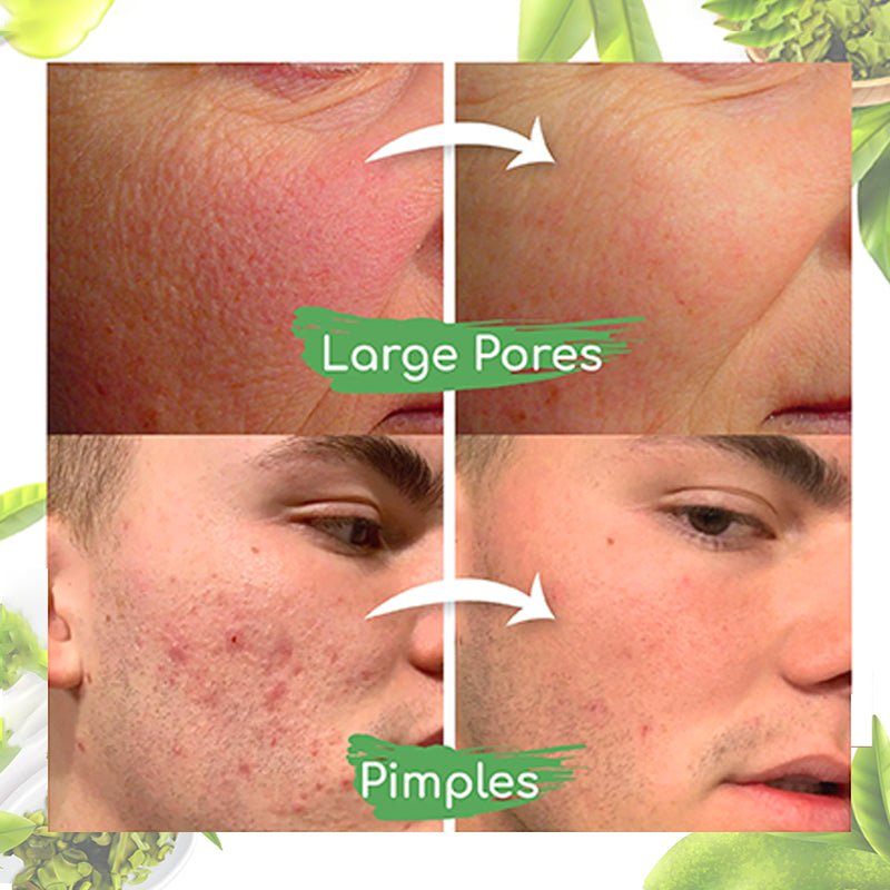 Seurico™ Green Tea Clay Mask Stick For Oil Control, Blackhead Reduction, and Pore Minimization