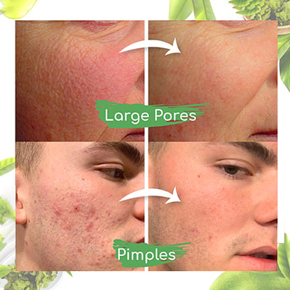 Seurico™ Green Tea Clay Mask Stick For Oil Control, Blackhead Reduction, and Pore Minimization