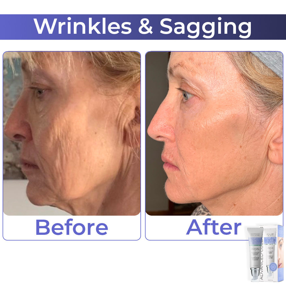 JEREMYTIS™ Advanced Collagen Complete Eye Cream