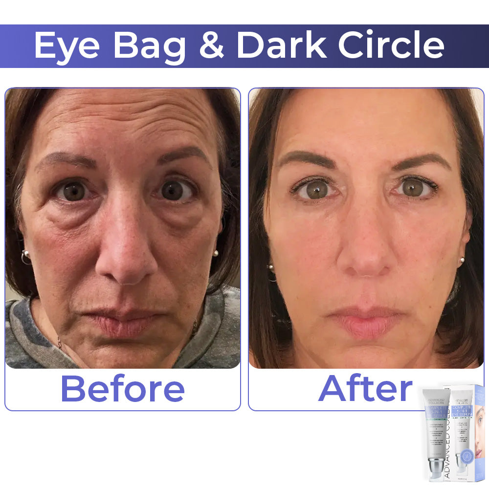 JEREMYTIS™ Advanced Collagen Complete Eye Cream