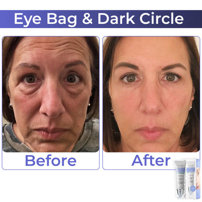 JEREMYTIS™ Advanced Collagen Complete Eye Cream