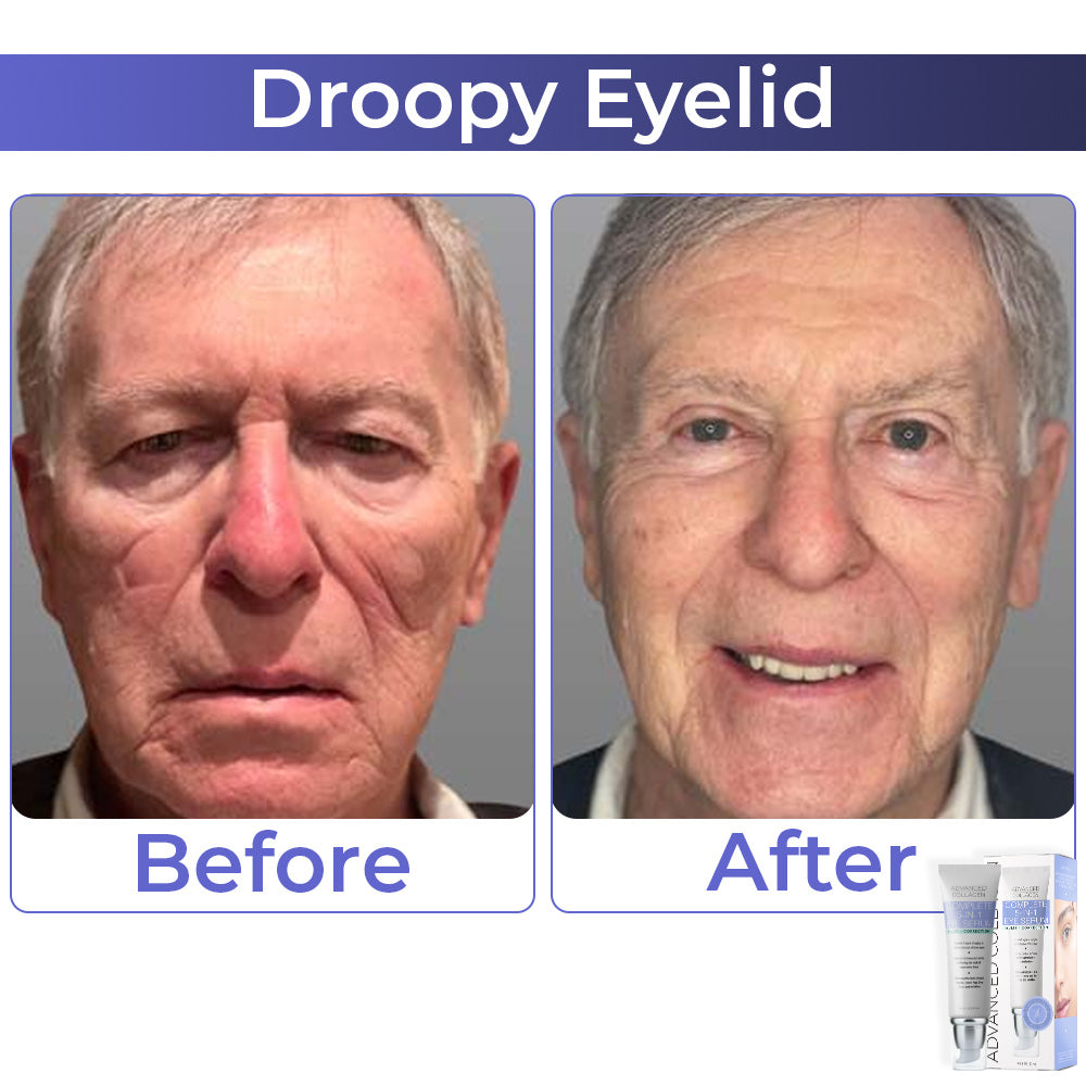 JEREMYTIS™ Advanced Collagen Complete Eye Cream