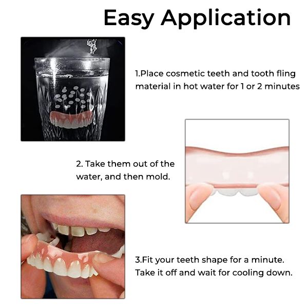 Seurico™ Soft Denture Reline Kit