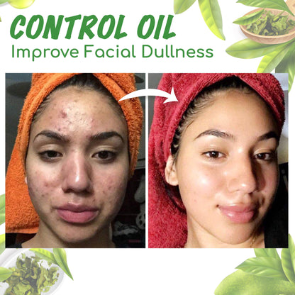 Seurico™ Green Tea Clay Mask Stick For Oil Control, Blackhead Reduction, and Pore Minimization